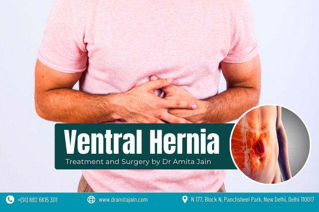 Dr Amita Jain best surgeon for ventral hernia in Delhi and India